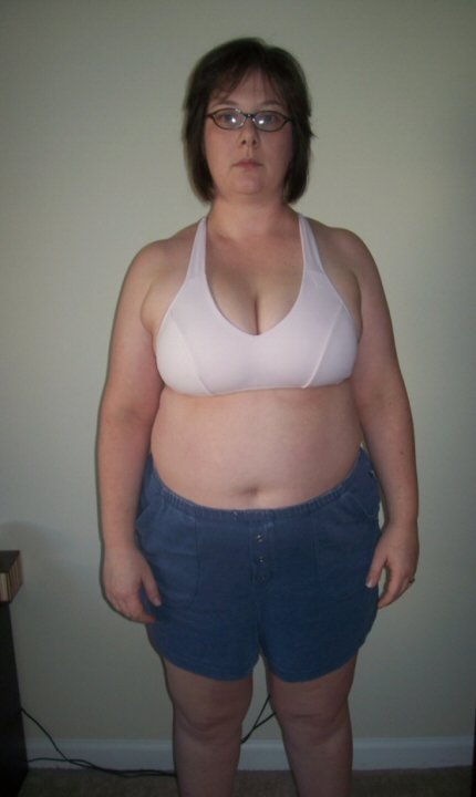 Gastric Sleeve Surgery in Mexico